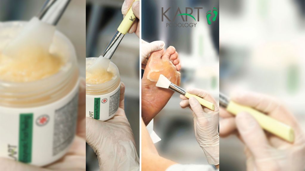 Podoloji Kart Pedikür